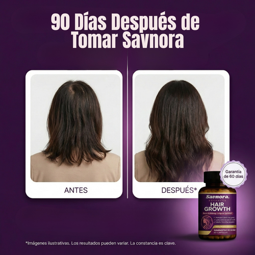 Hair Growth Vitamins™ - Frena la Caída En 2 Semanas